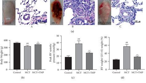 miao lv shoes|Tetramethylpyrazine Improves Monocrotaline.